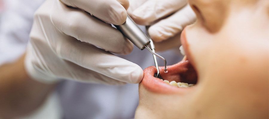 تجميل الأسنان - ما هي أحدث طرق علاج وتبييض الأسنان الفعالة؟ | مدونة كشفية