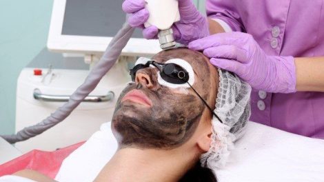 أسعار الليزر الكربوني