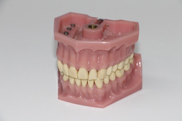 تركيبة اسنان متحركة تجميلية