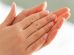 علاج تشققات اليدين والاكزيما